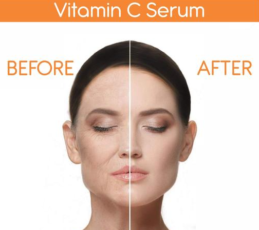 Vibrance Vitamin C Serum Australia vhjghk.PNG