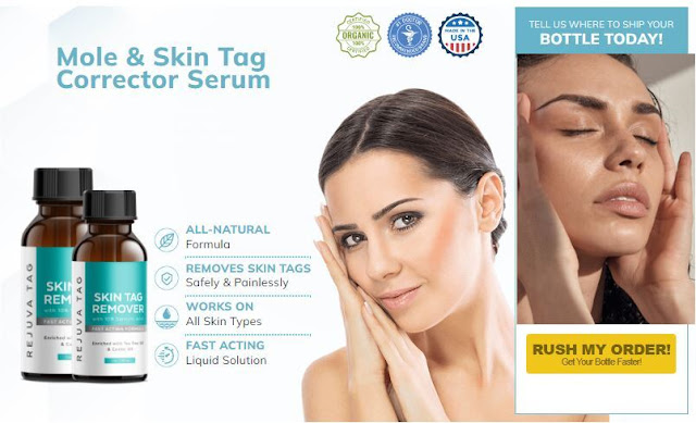 Skin Solutions Skin Tag Remover get.jpeg