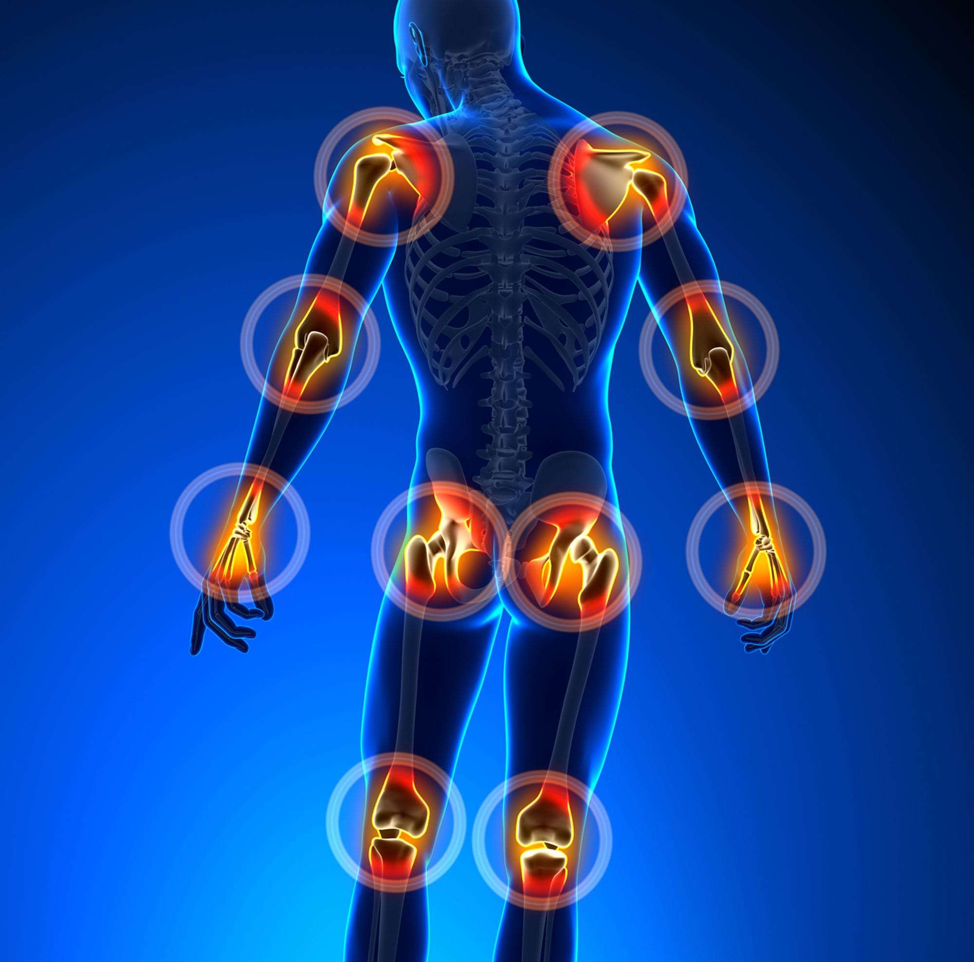 Arthro MD Canada 3.jpg